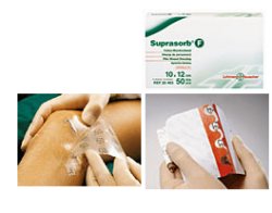 MEDICAZIONE STERILE IN FILM IN POLIURETANO TRASP. SUPRASORB F 10X12CM 10 PEZZI - farmasconti.eu