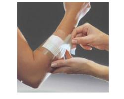 FILM ADESIVO IN POLIURETANO IN ROTOLO TRASPARENTE IMPERMEABILE PER FISSAGGIO DI MEDICAZIONI E CATETERI 10X1000CM 1 PEZZO - farmasconti.eu